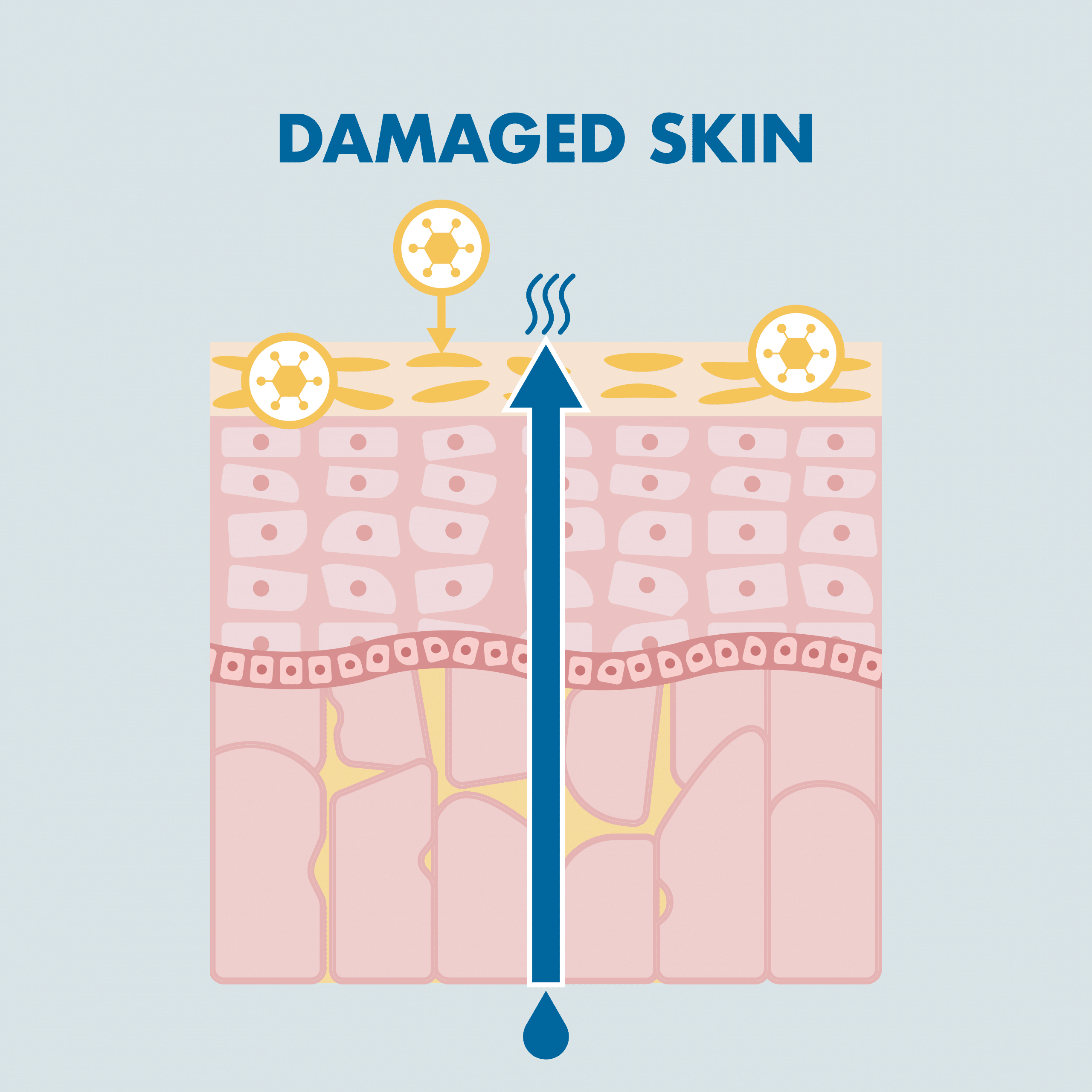 Damaged skin of the skin barrier