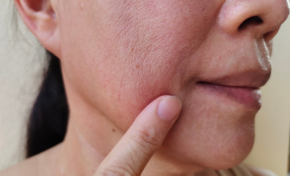 portrait the flabbiness and wrinkle corner of the mouth, smile lines and flabby skin beside the mouth , dark spots and dull skin, freckles and blemish on the face, health care and beauty concept.